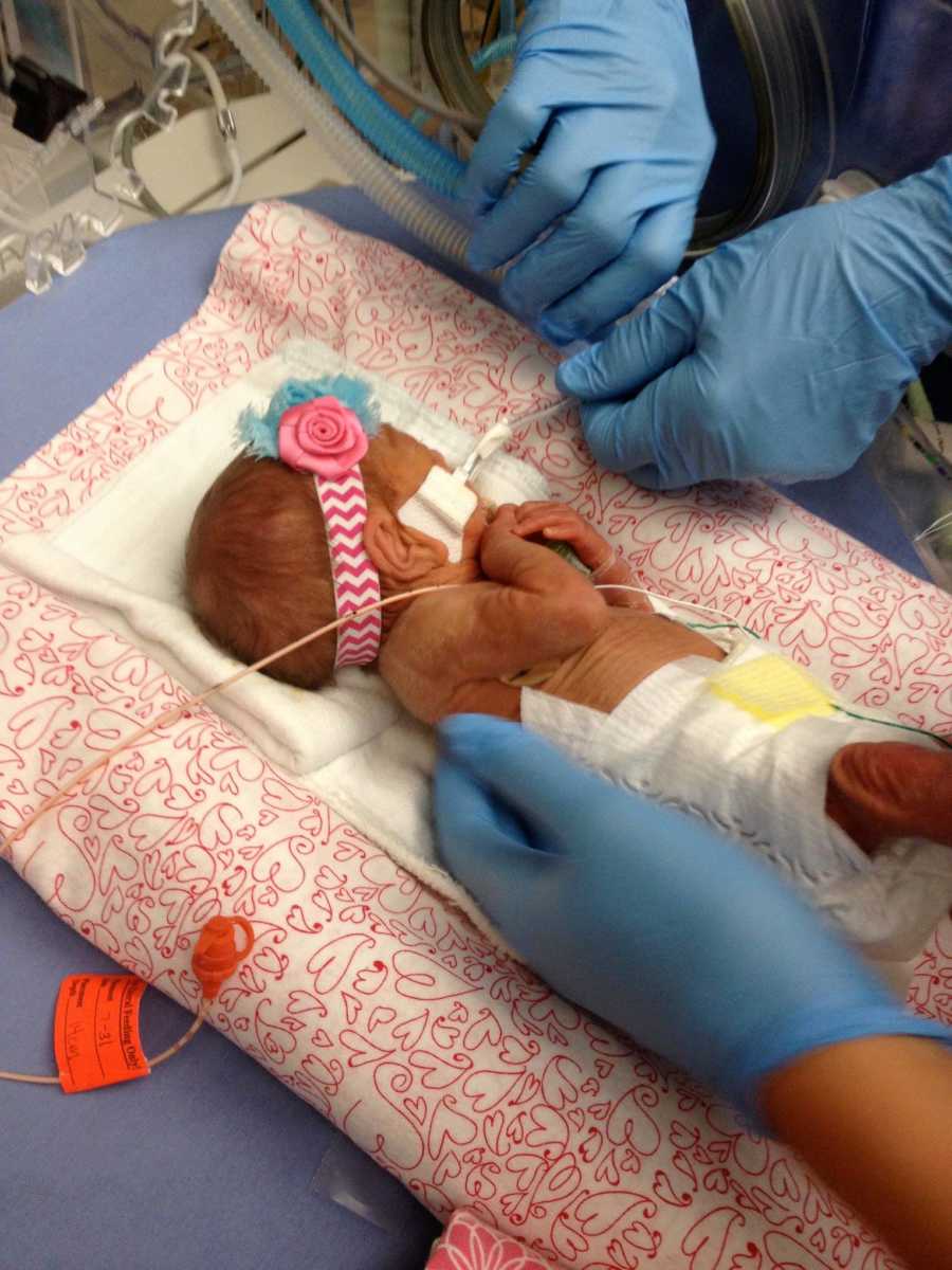 Intubated preemie lays in NICU with flower headband on their head