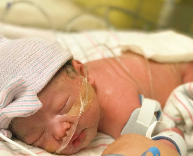 Intubated baby girl lays asleep in NICU