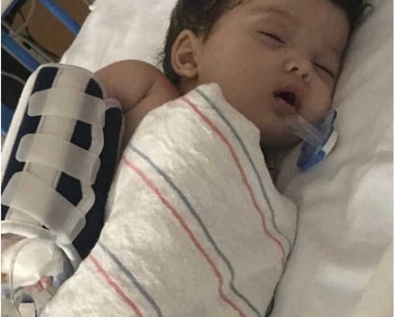 Newborn lays asleep in NICU with brace on her arm