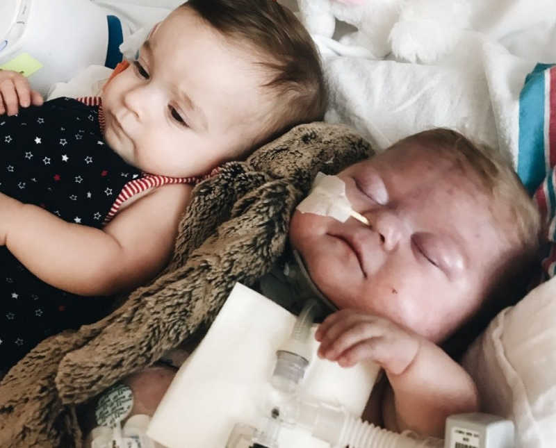 Intubated baby lays asleep after heart surgery beside her twin