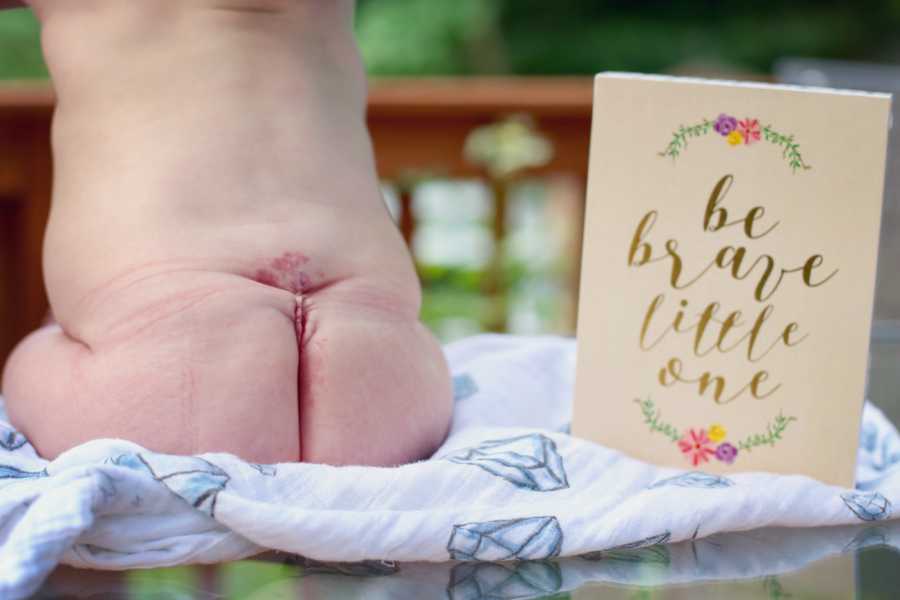 Baby sits without diaper on to shoe scar on her back beside card that says, "be brave little one"