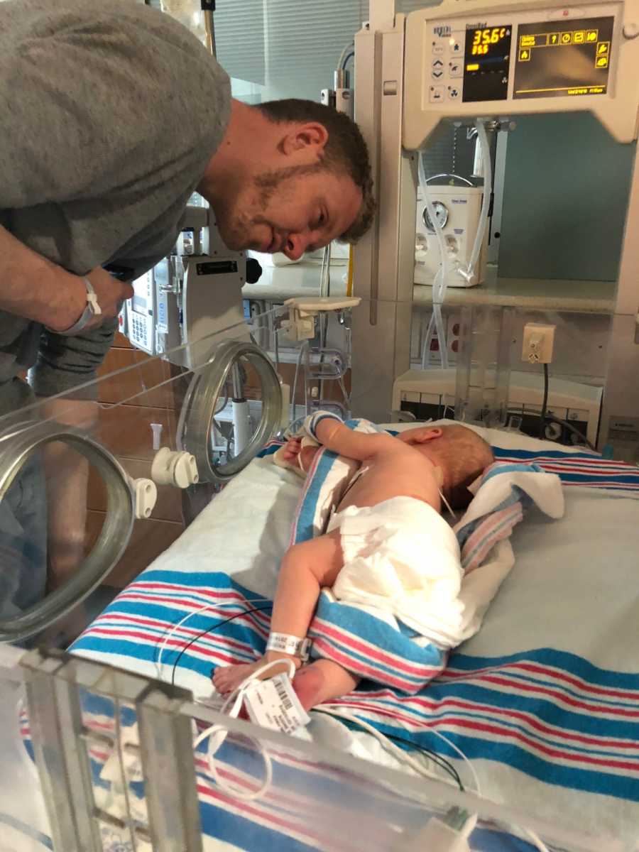 Newborn baby lays asleep in NICU after surgery while her father stands over her