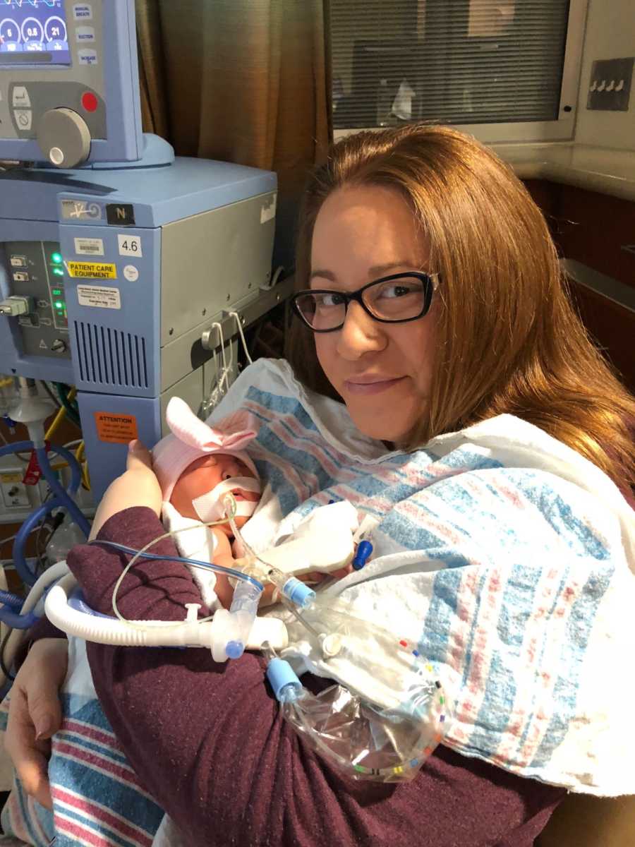 Intubated newborn lays asleep in mother's arms before her surgery