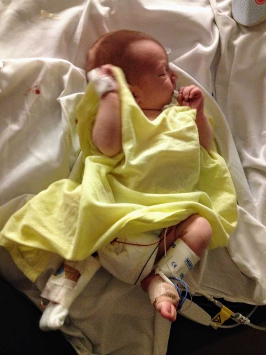 Newborn in oversized yellow tank top lays on back hooked up to monitors before taken to different hospital