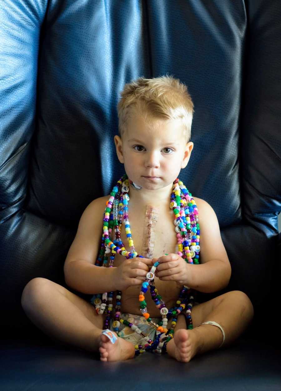 Little boy with congenital heart defects sits in chair with scars showing and beaded necklaces on