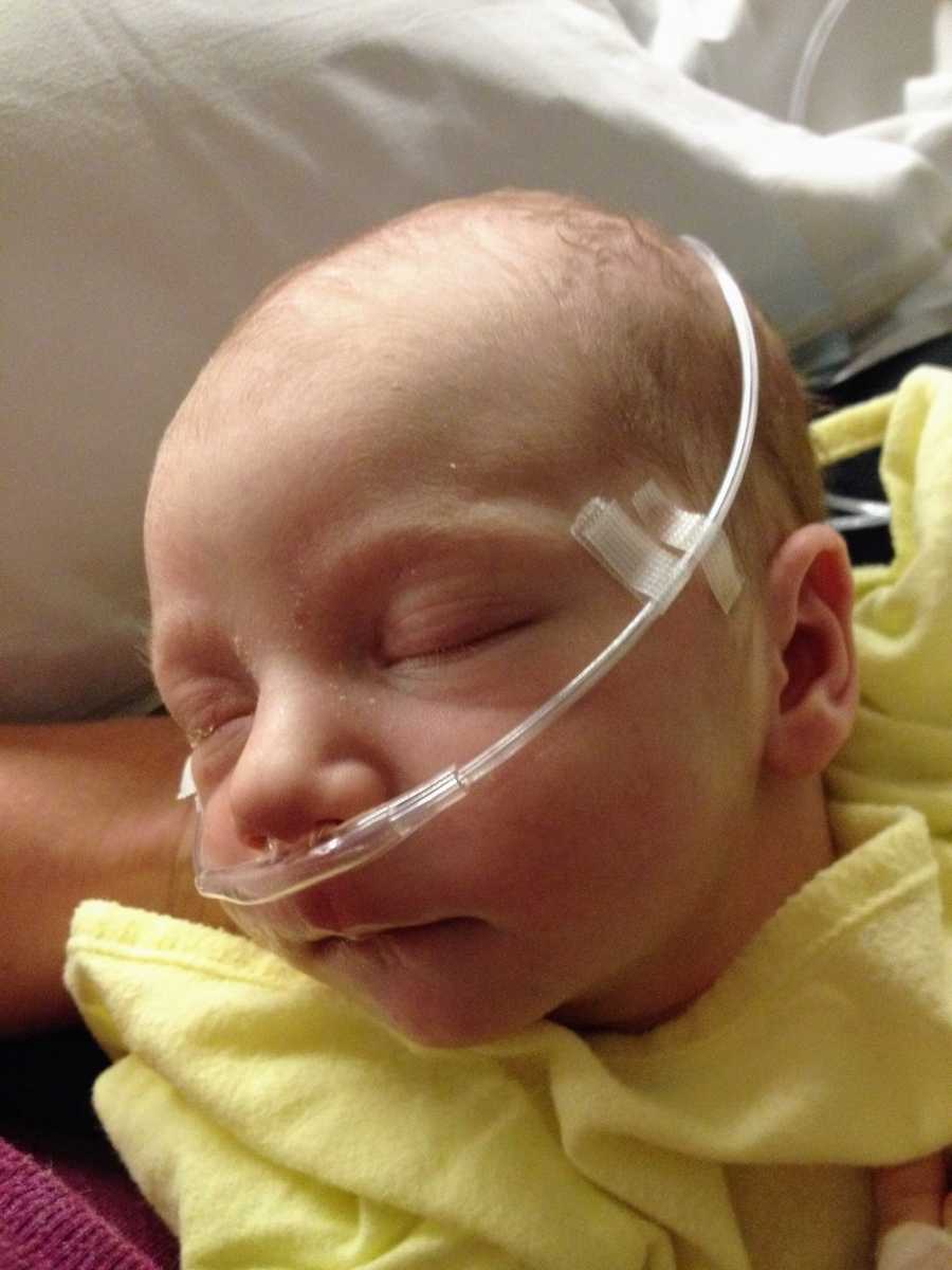 Close up of intubated baby asleep 