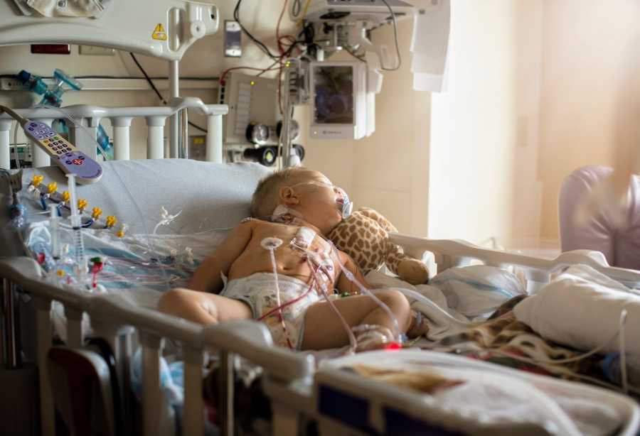 Intubated little boy with congenital heart defects lays asleep in hospital bed