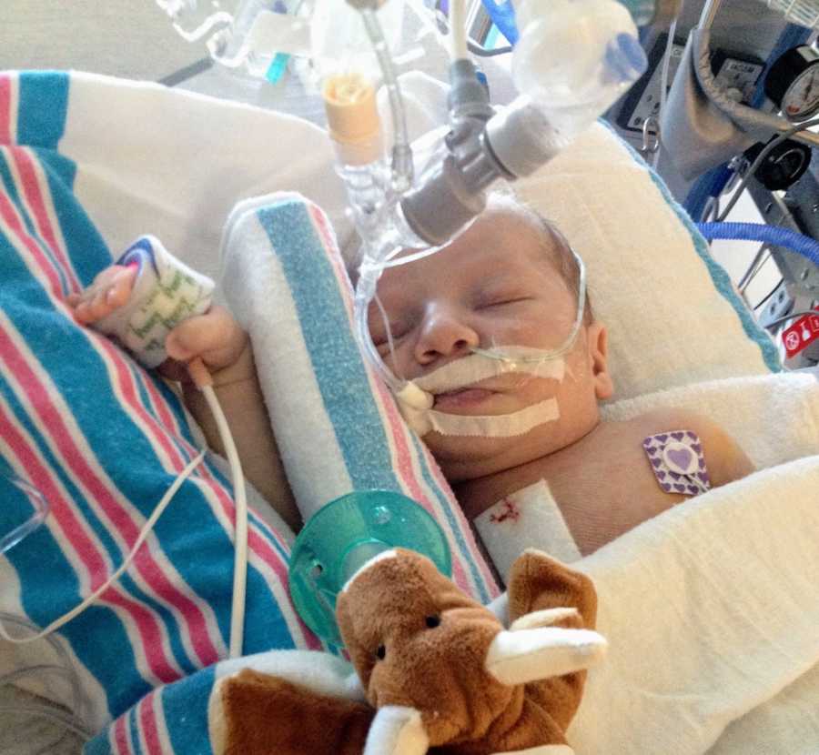 Intubated baby lays asleep in hospital bed after open heart surgery