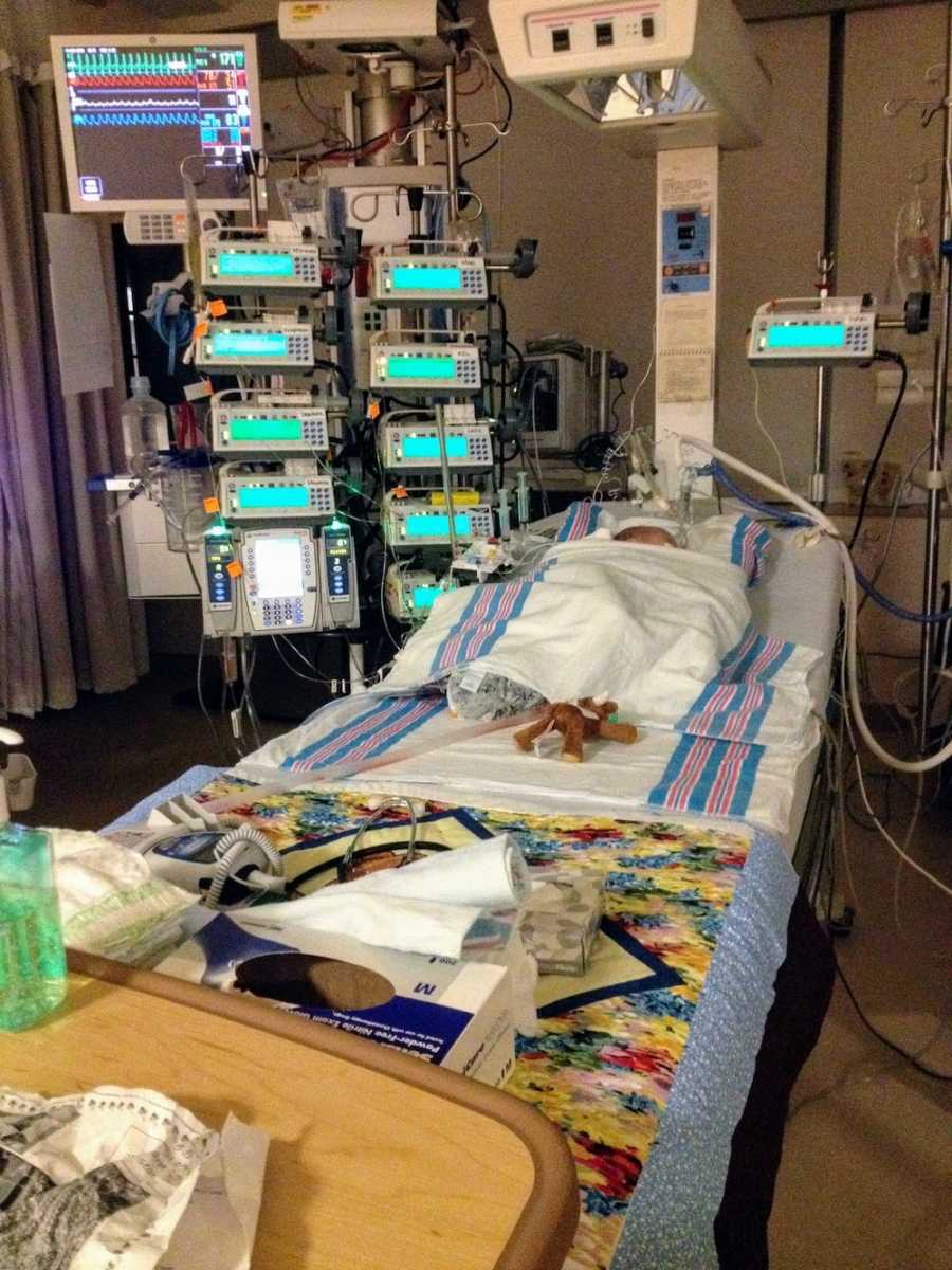 Intubated baby lays asleep in hospital bed hooked up to monitors after open heart surgery