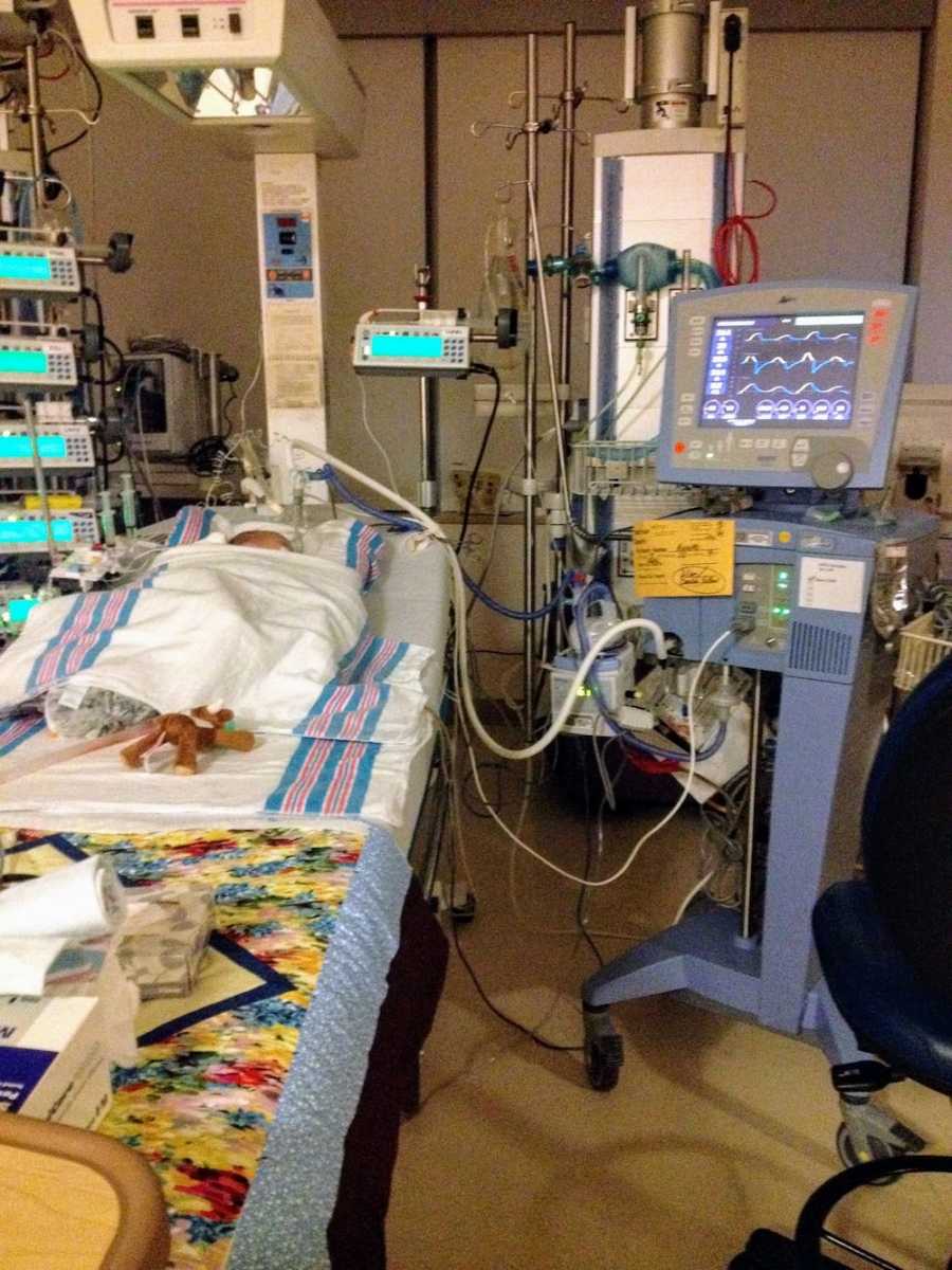 Baby lays asleep in hospital bed hooked up to monitors after open heart surgery