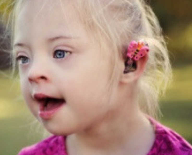 Little girl with down syndrome stands outside with hearing aid in with fake butterfly on it