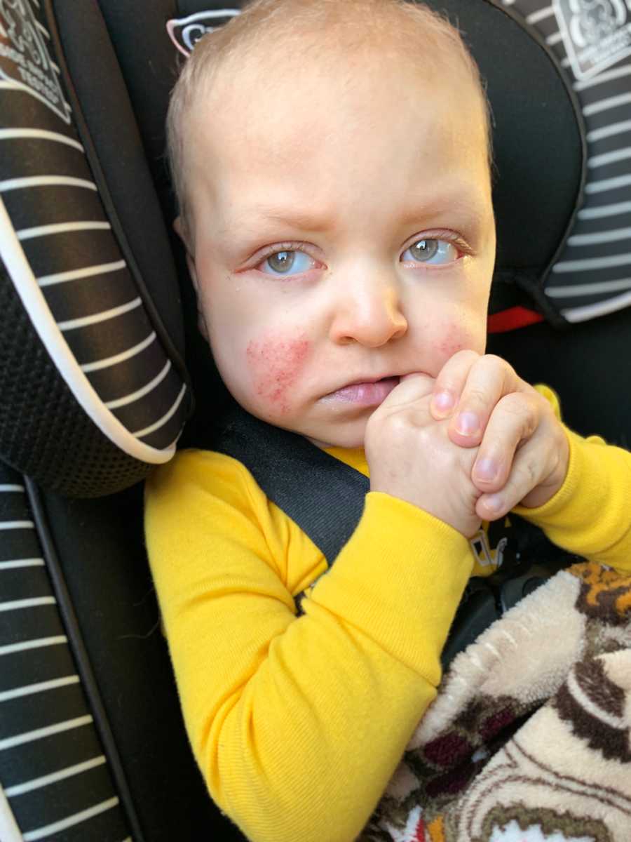 Baby boy with Kabuki Syndrome sits strapped in car seat
