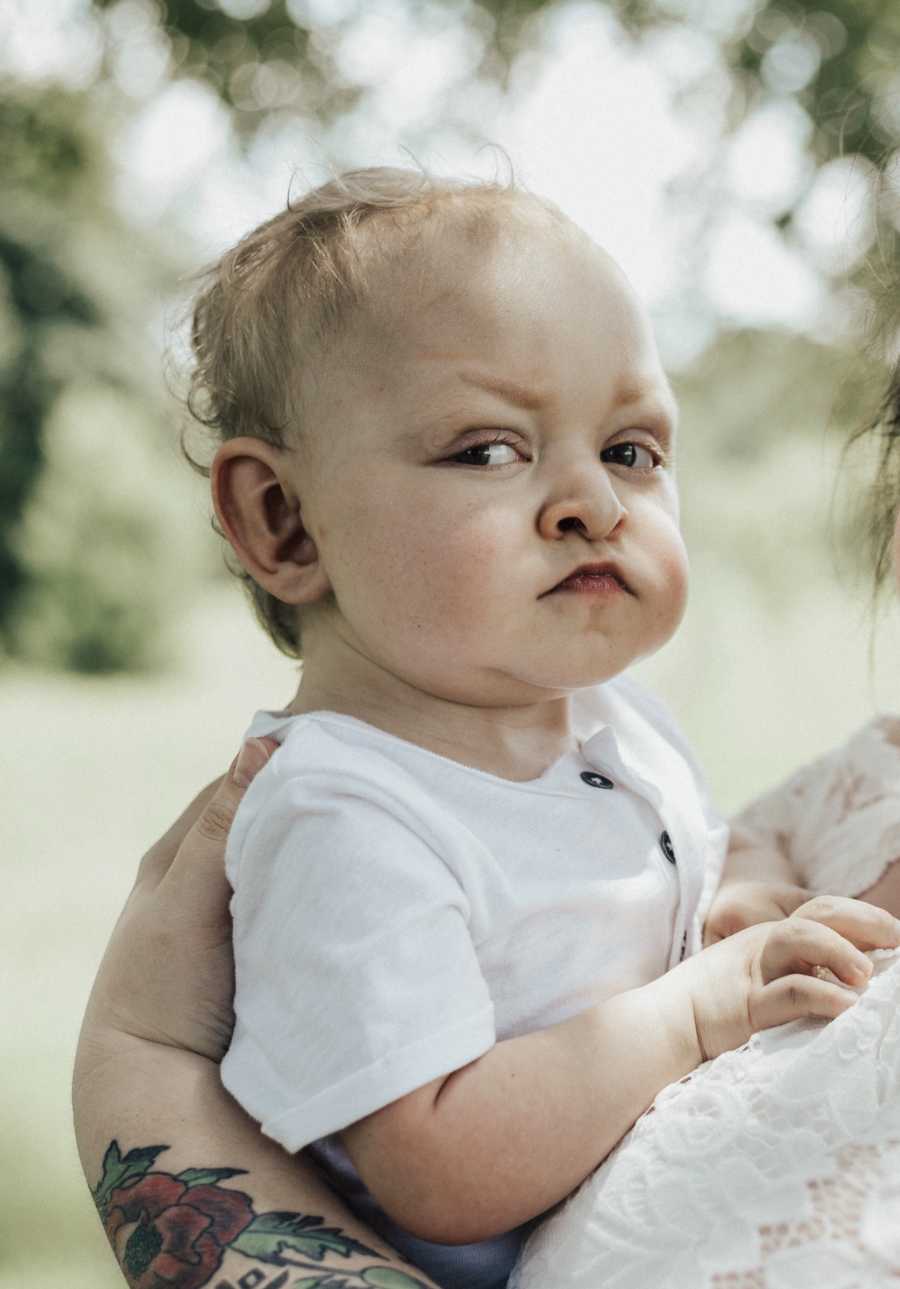 Baby with Kabuki Syndrome is held in arms of mother