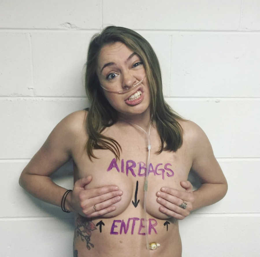Woman on feeding tube stands shirtless while holding her breasts
