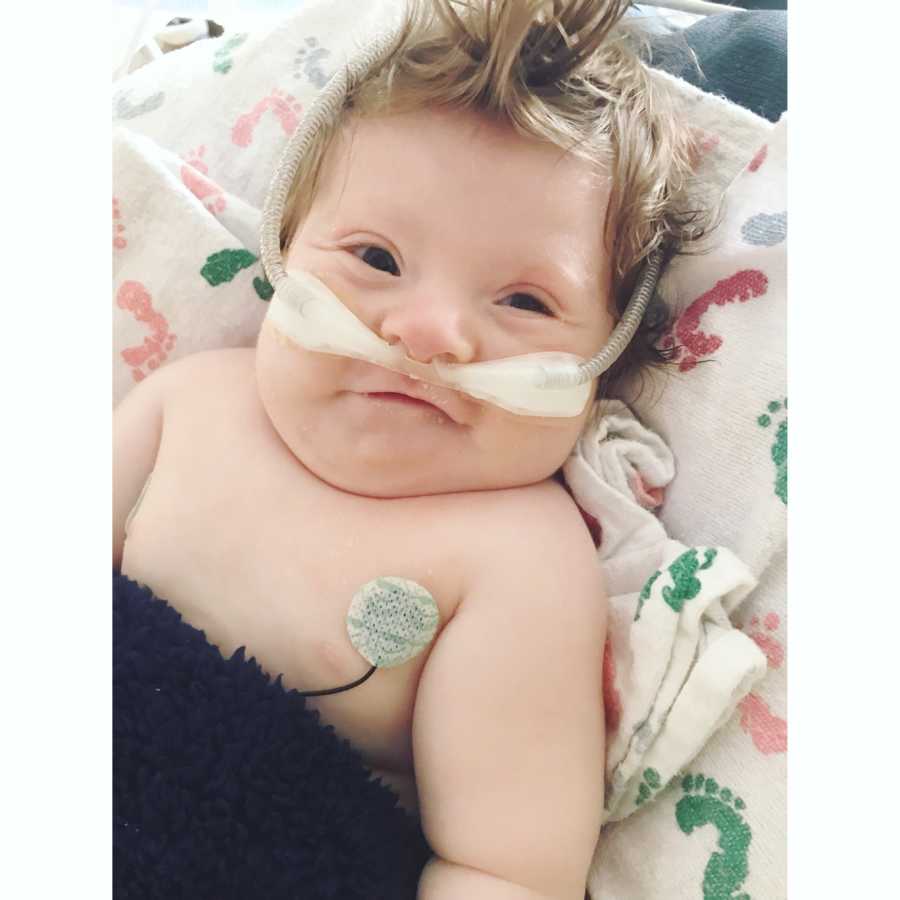 Baby boy on oxygen with Hypertrophic Cardiomyopathy smiles as he lays on back in PICU