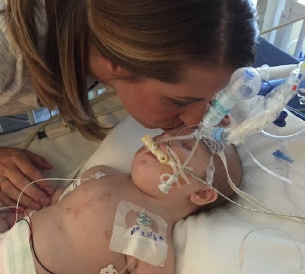 Mother kisses head of intubated newborn who underwent open heart surgery