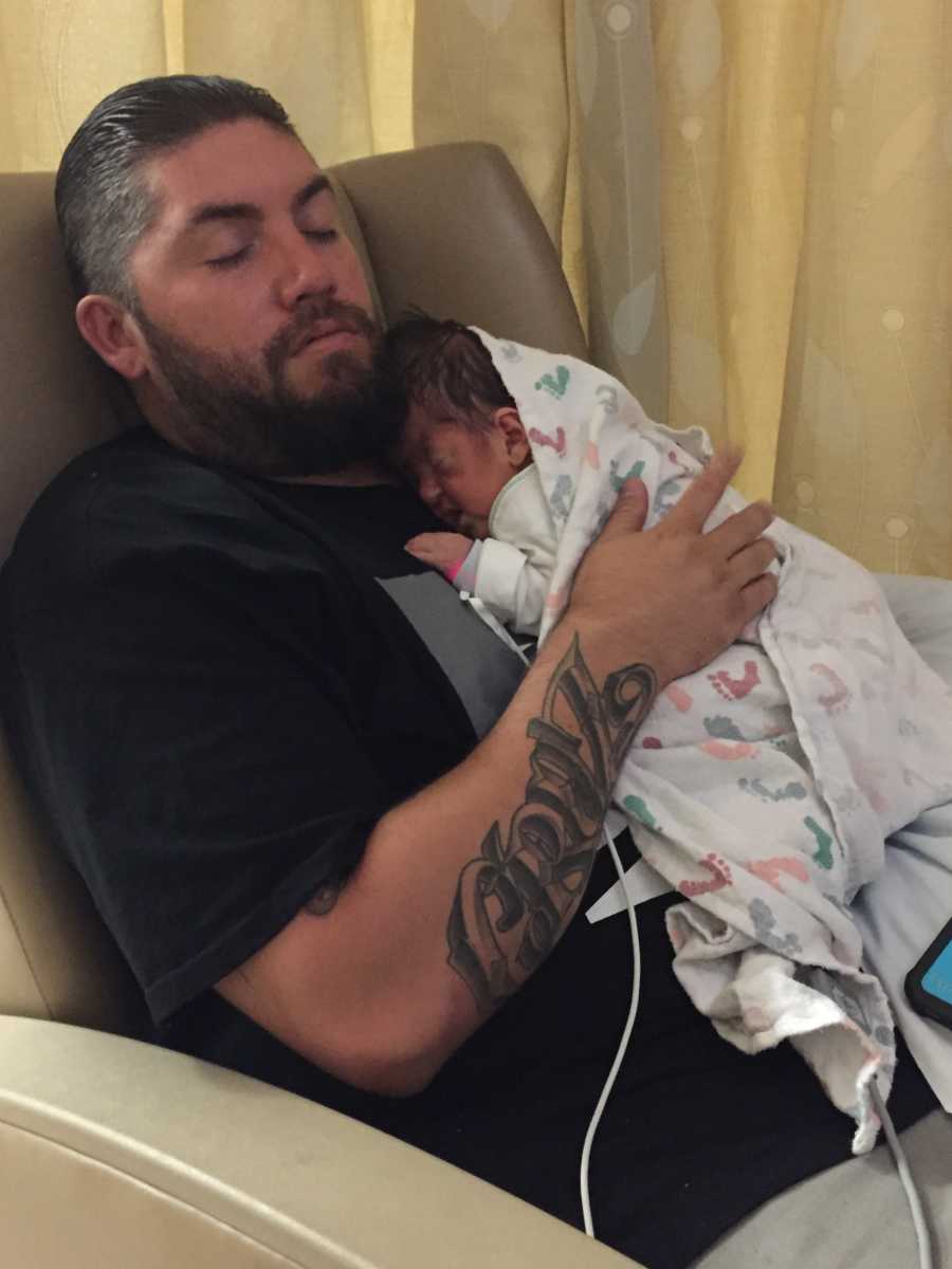 Father sits asleep in NICU with newborn with Apert syndrome laying on his chest