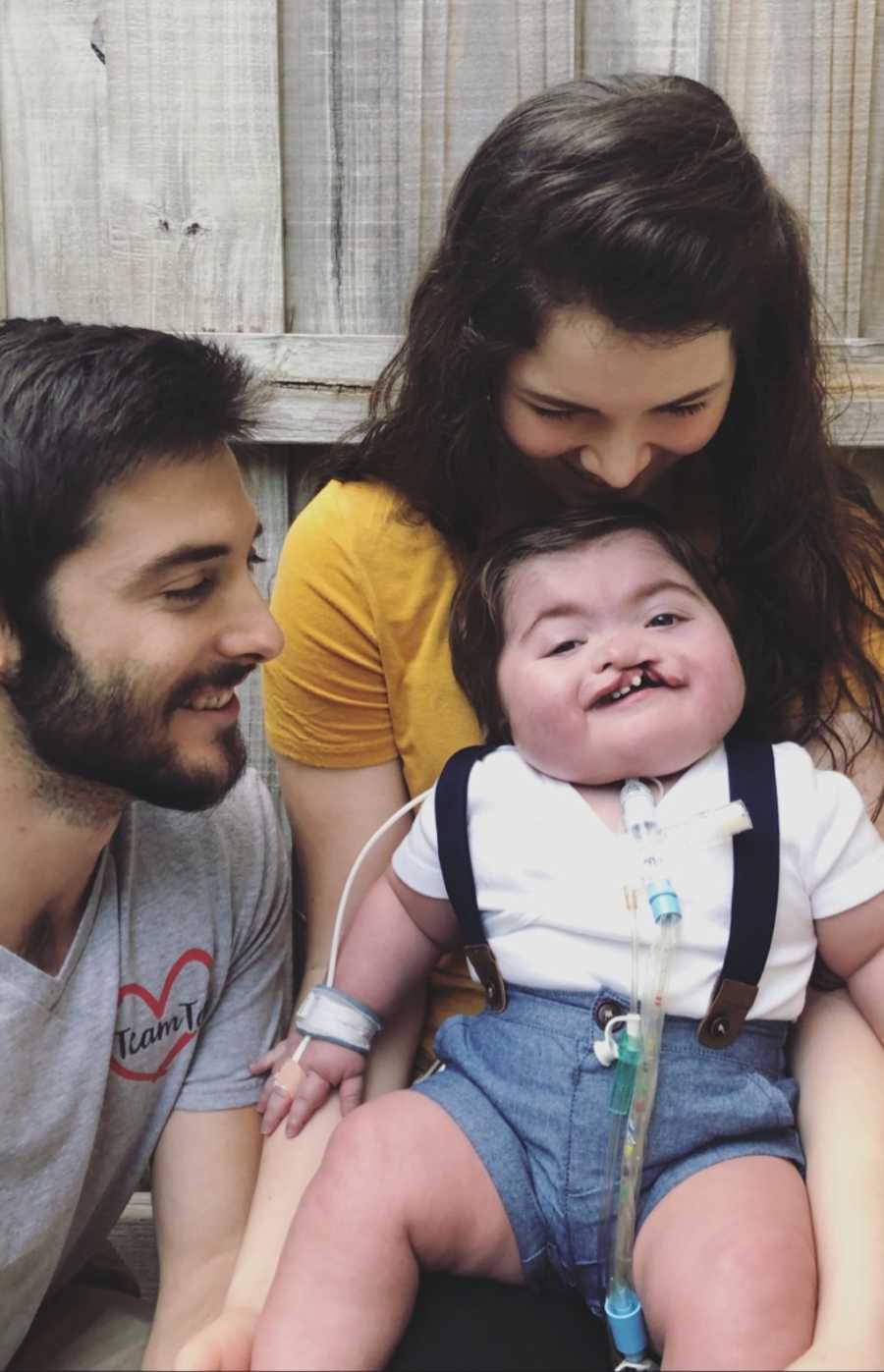 Mother looks down at baby boy with cleft palate as husband looks over at son smiling