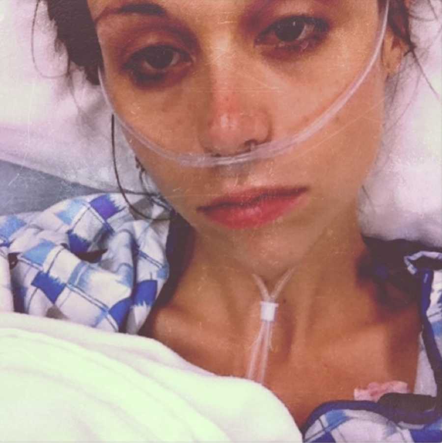 Young woman who is a drug addict and has eating disorder lays in hospital tube up her nose