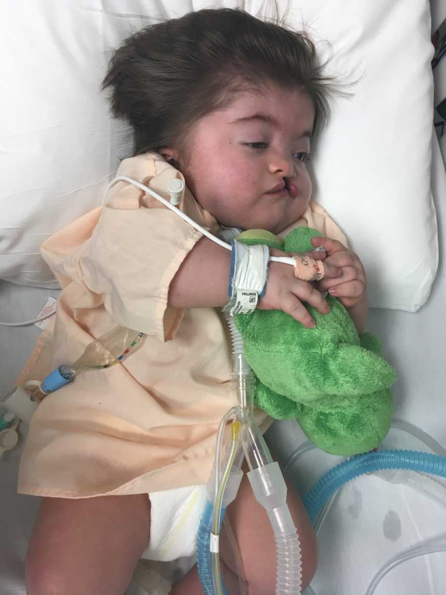 Baby with trach lays on back in NICU holding green stuffed animal