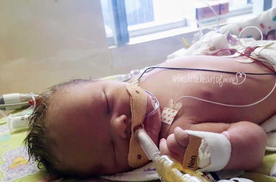 Intubated newborn lays on back asleep in NICU