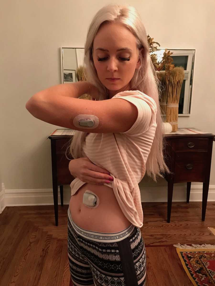 Woman stands in home with diabetes patch on her arm and stomach