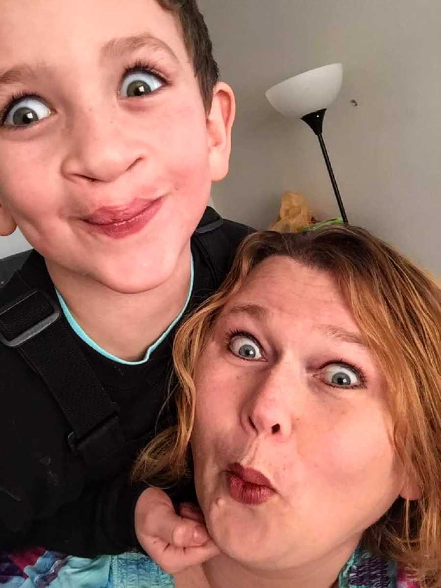 Mother and son who had cleft lip and palate surgery make silly faces in selfie