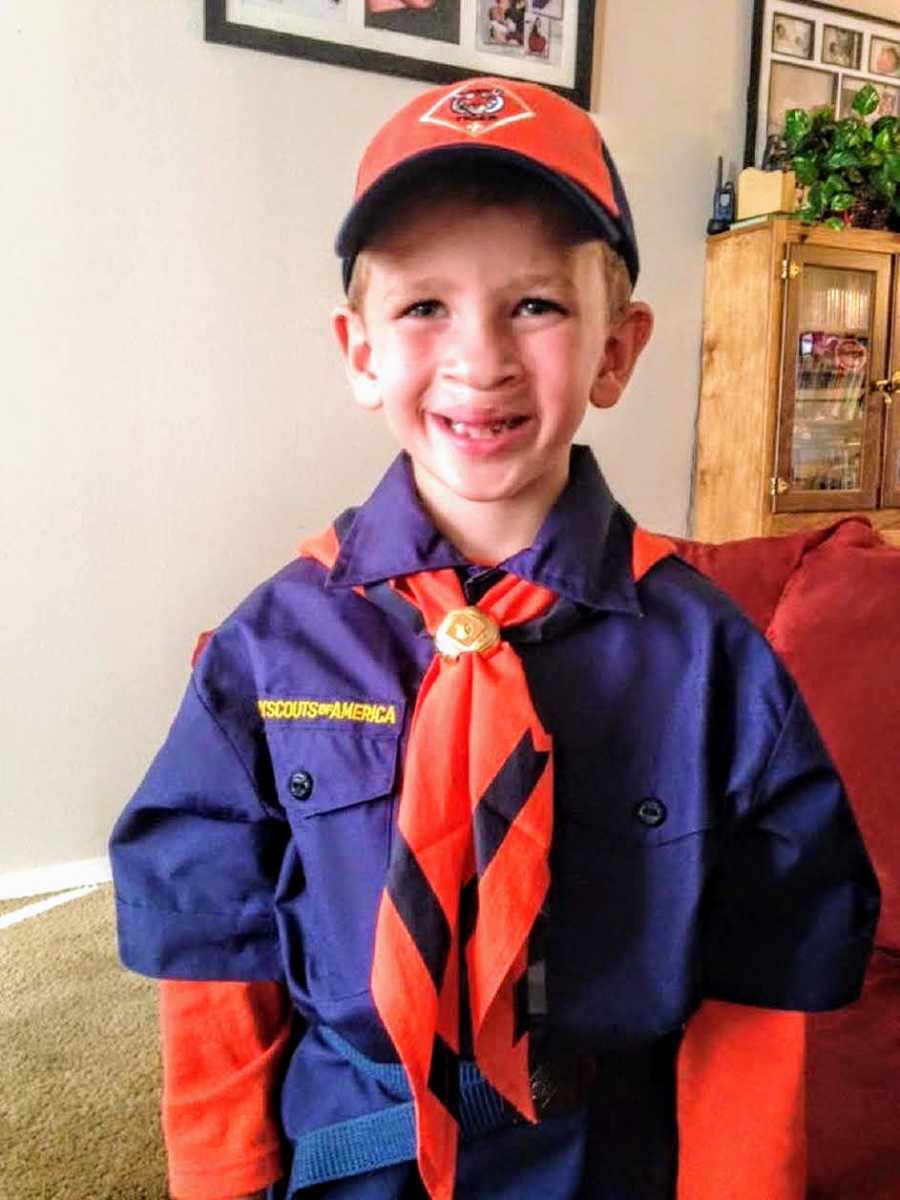 Little boy who had cleft lip and palate surgery as a baby stands smiling in home in boy scouts uniform
