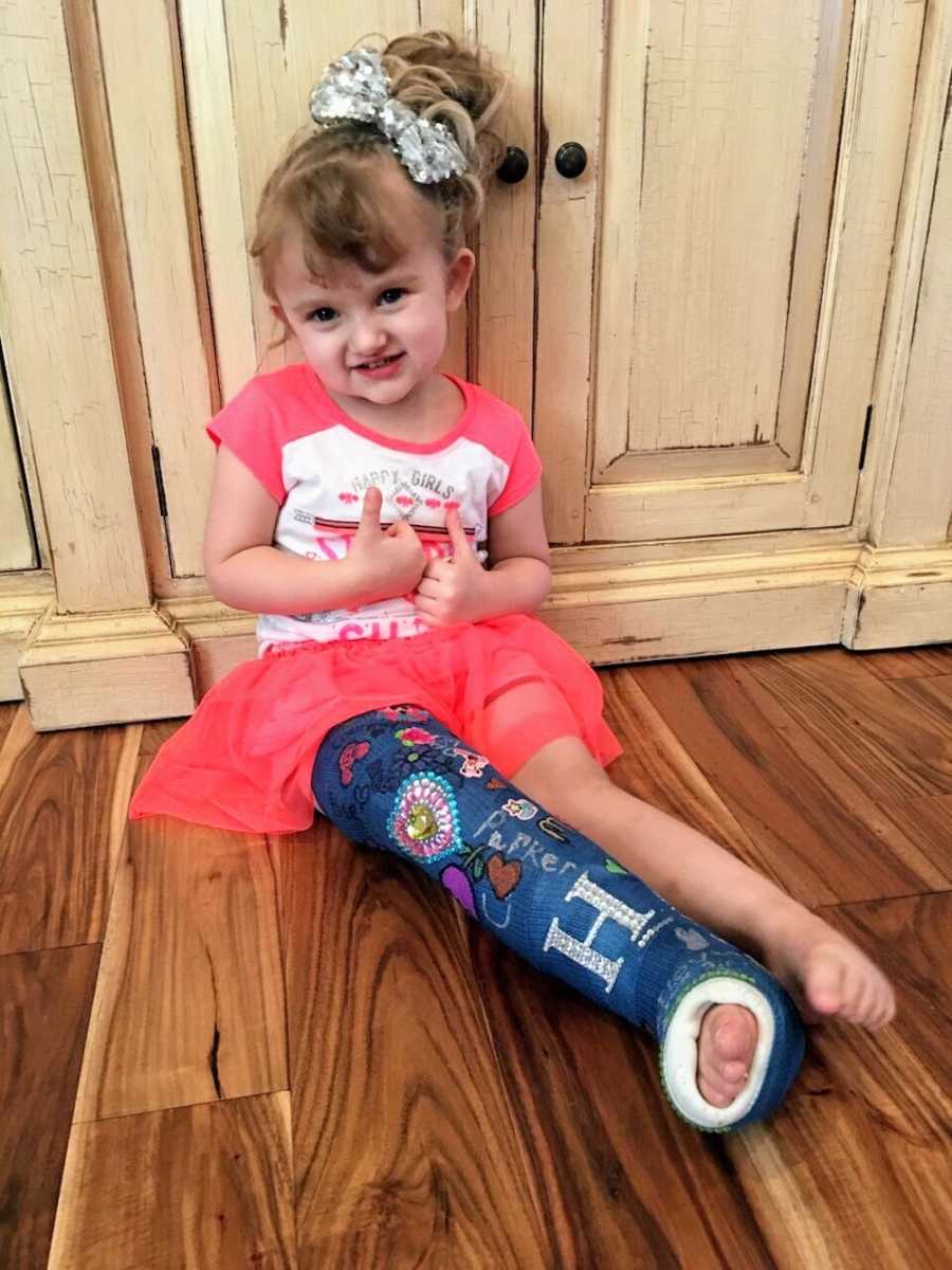 Little girl with Osteogenesis Imperfecta sits on floor of home smiling with cast on her leg