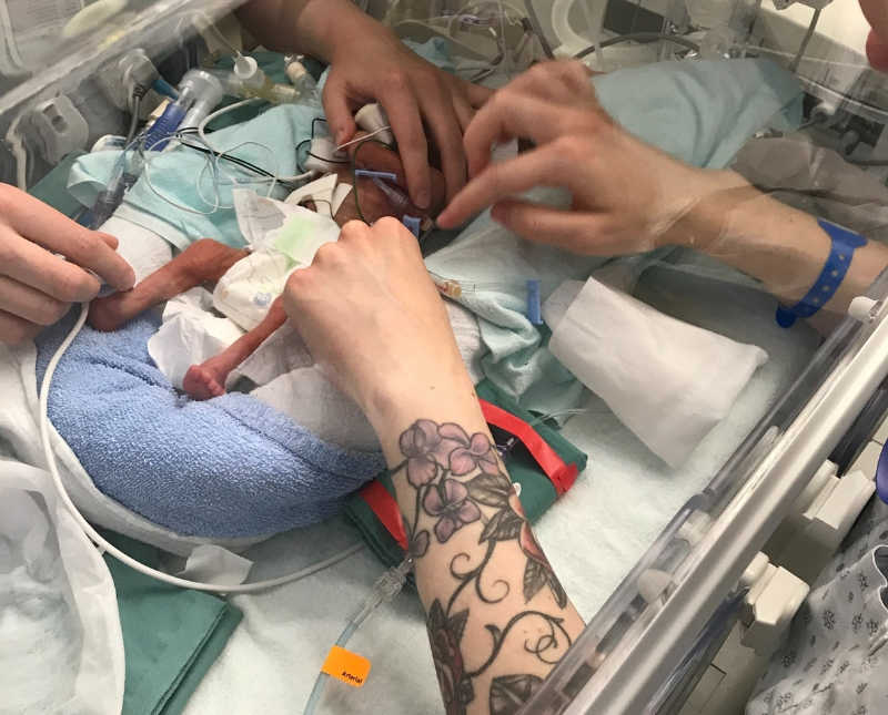 Parents touch newborn who lay in NICU awaiting brain surgery