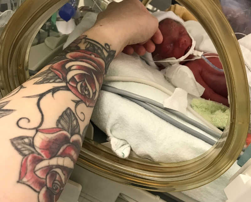 Mother touches head of newborn in NICU who had brain surgery
