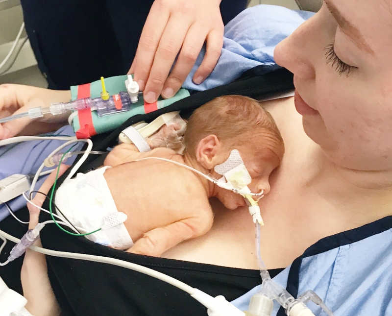 Intubated preemie lays on bare chest of mother