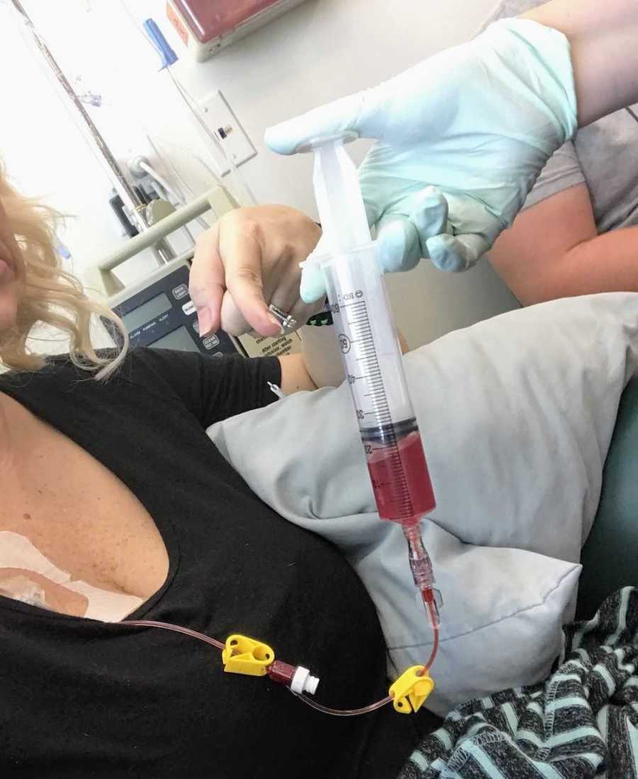 Doctor injects fluid into woman's IV who has Hodgkin's lymphoma