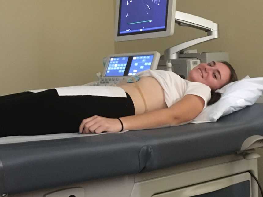 Young woman with MALS lays on doctors office table beside ultrasound machine