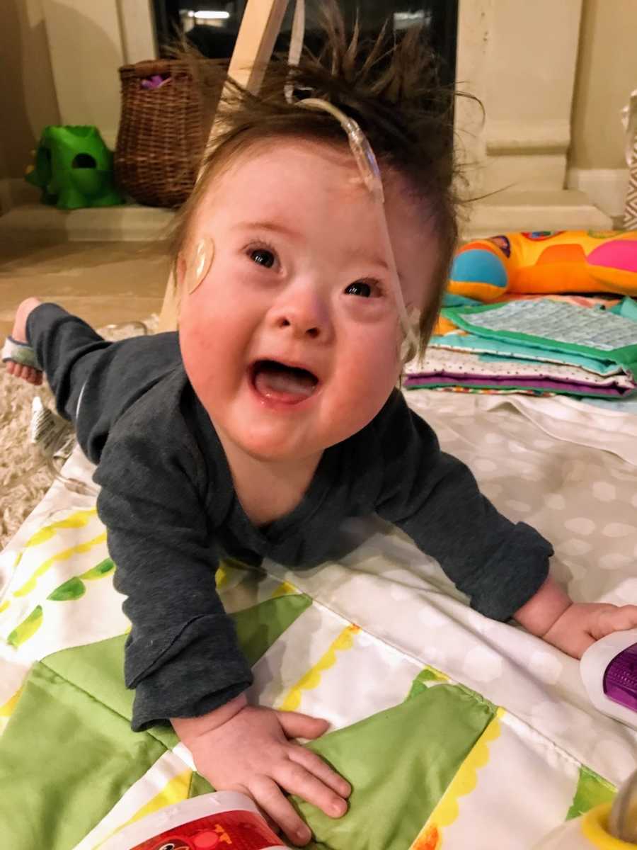 Little boy with down syndrome lays on his stomach smiling 