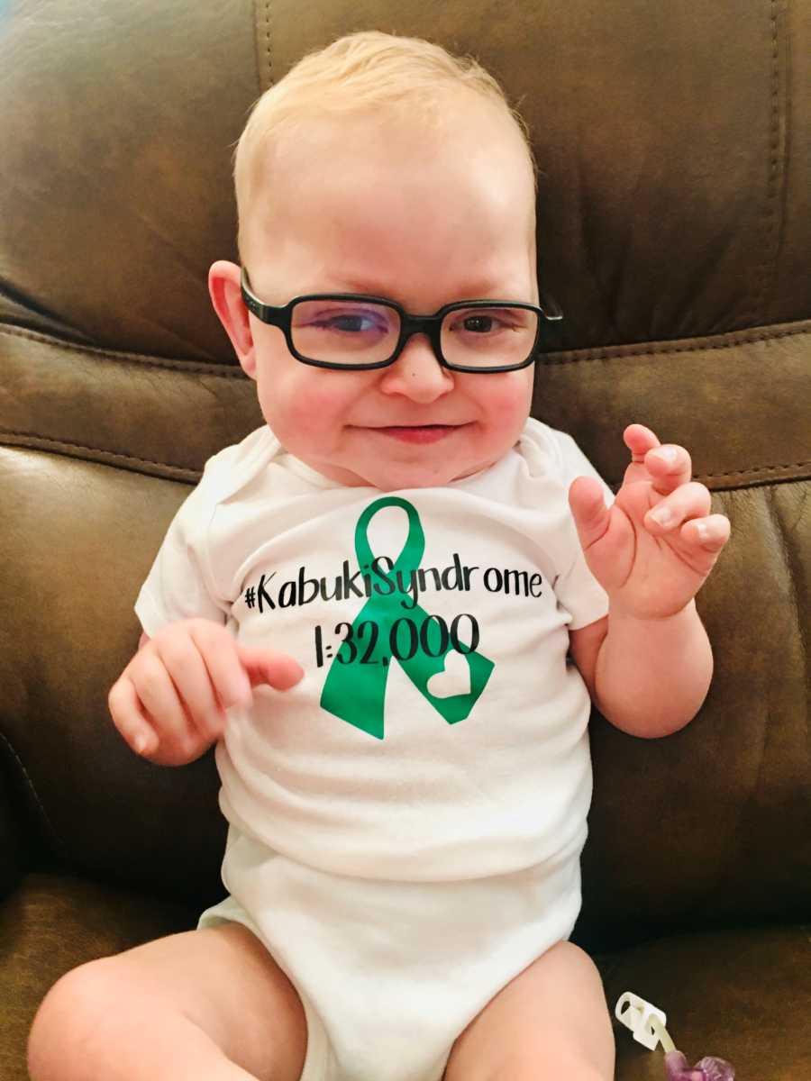 Baby with Kabuki Syndrome sits in chair with glasses on 