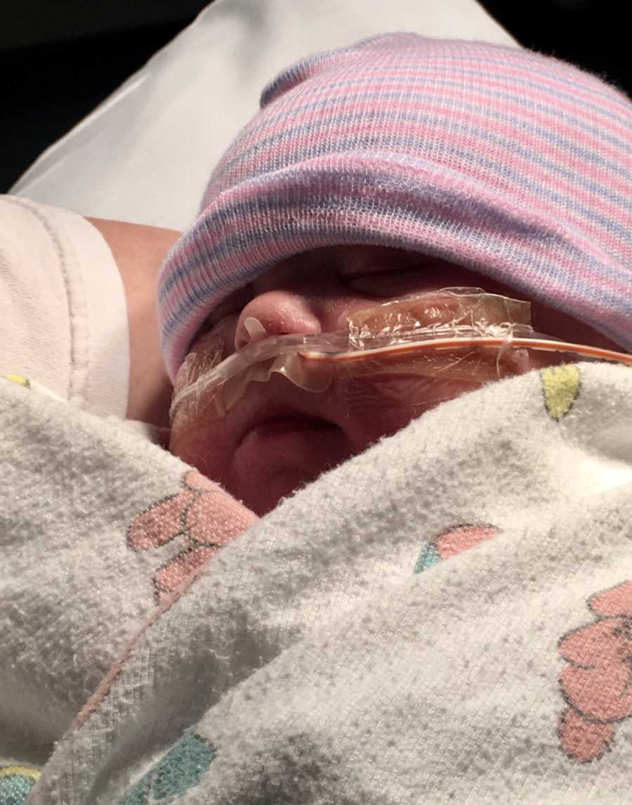 Intubated newborn with down syndrome lays asleep in arms of adult