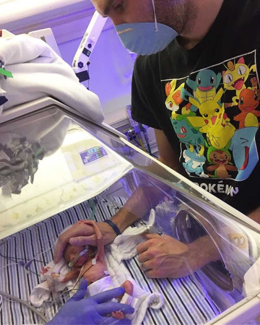 Father stands over preemie baby asleep in NICU