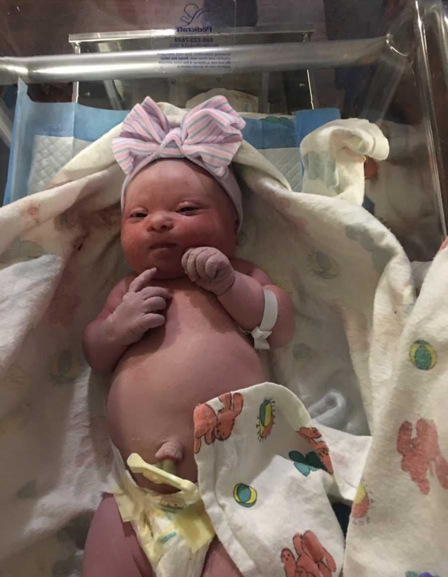Newborn with down syndrome lays on back in NICU