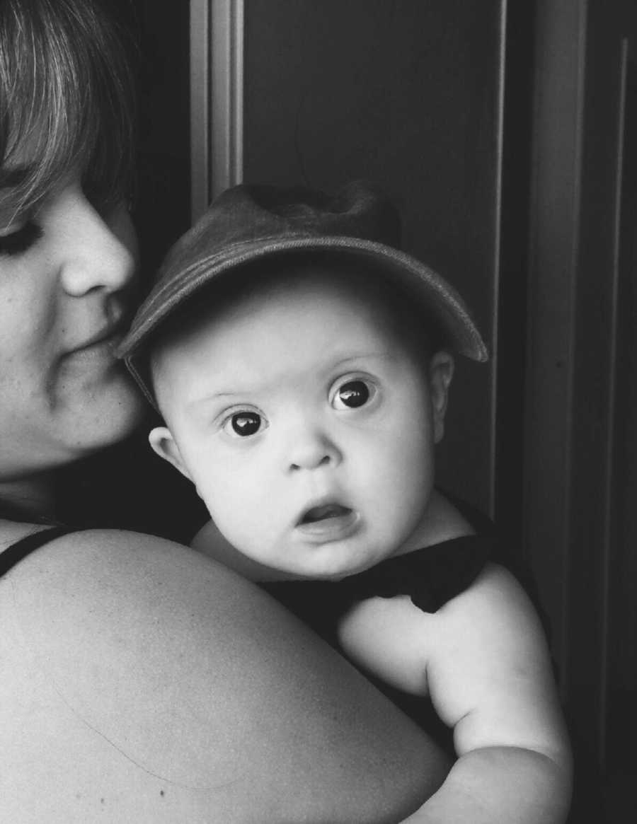 Mother looks at baby with down syndrome as she holds her in her arms