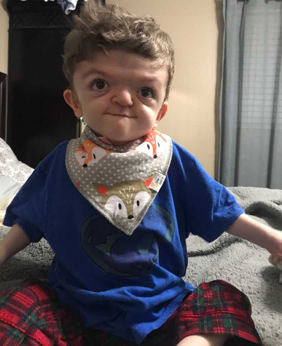 Young boy with apert syndrome sits on bed with bandana with foxes around his neck