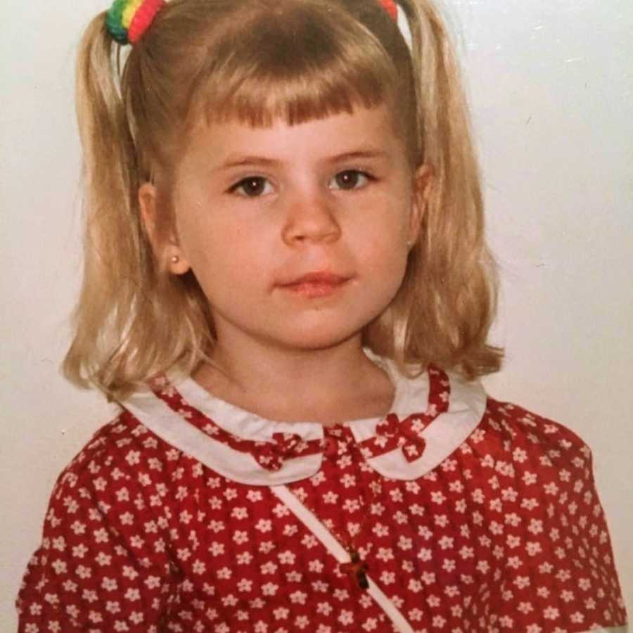 Little girl with cleft lip and palate in red dress with white flowers