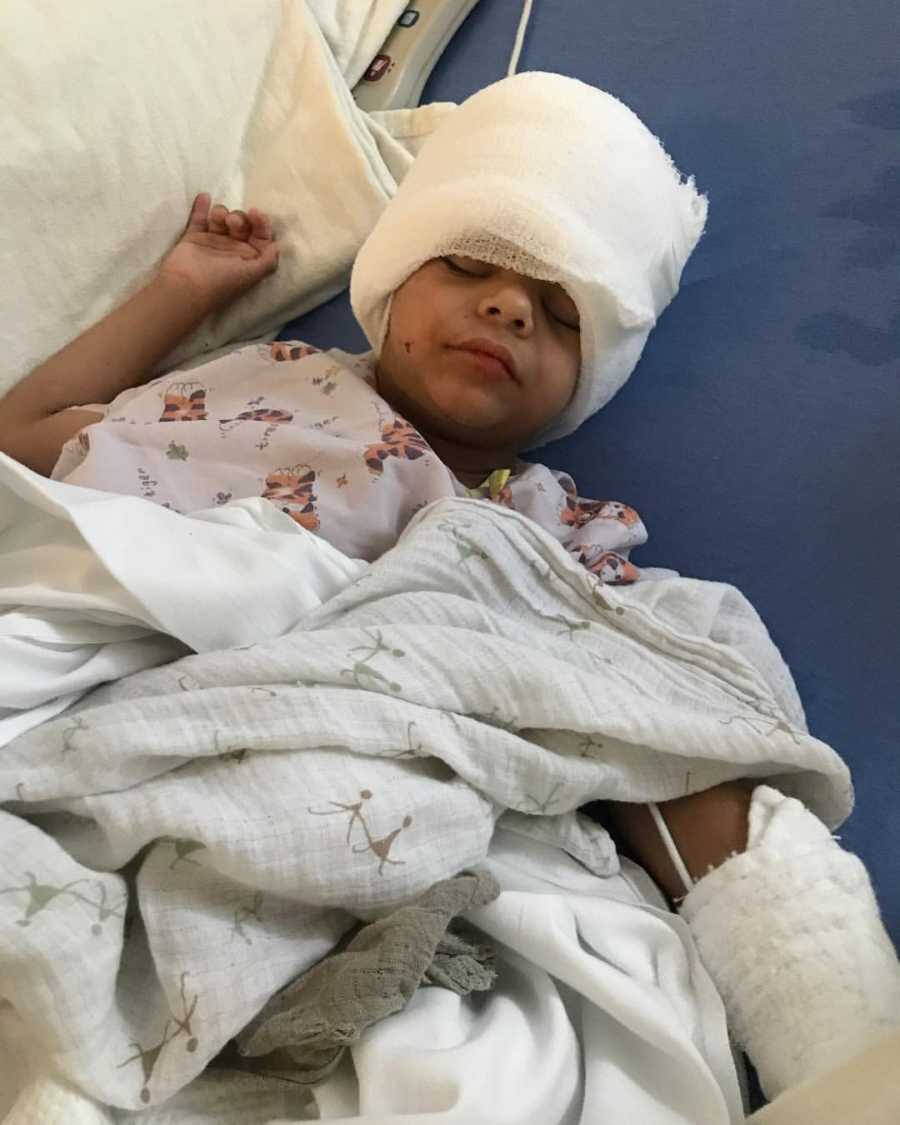 Little boy with Williams Syndrome lays asleep in hospital bed with bandages wrapped around his head