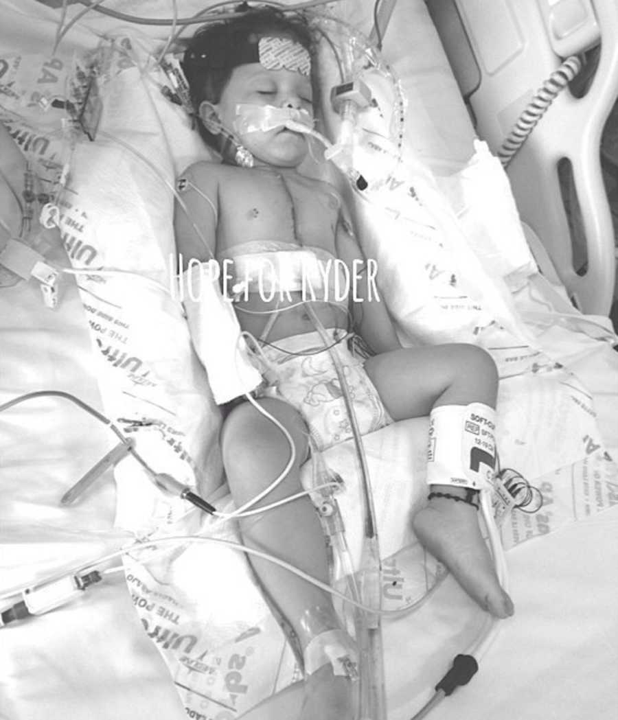 Intubated baby lays in hospital bed after having open heart surgery