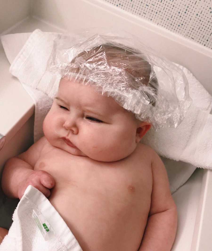 Baby with Aicardi Syndrome lays on back with hair net on