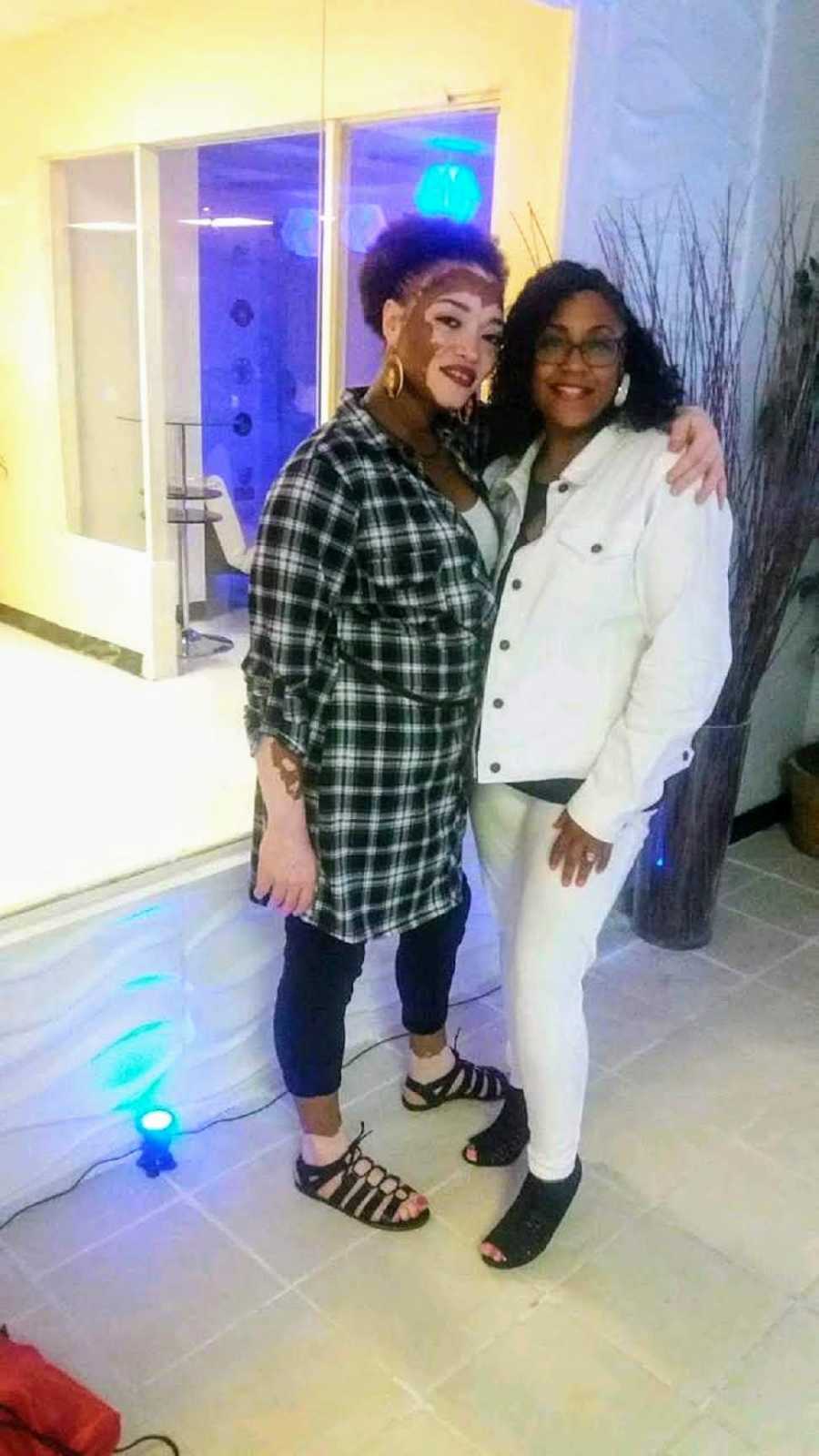 Woman with vitiligo stands smiling with arm around friend