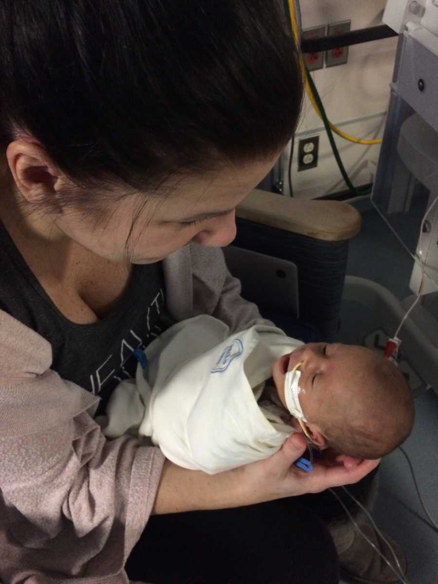 Mother sits in NICU holding intubated baby with tumor