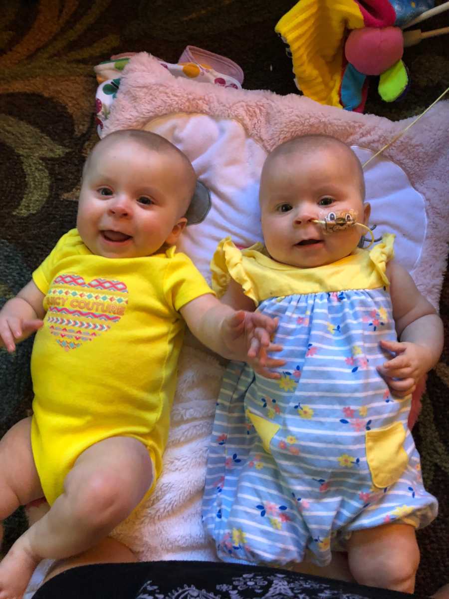 Baby girls with cancer lay on their backs on blanket in home