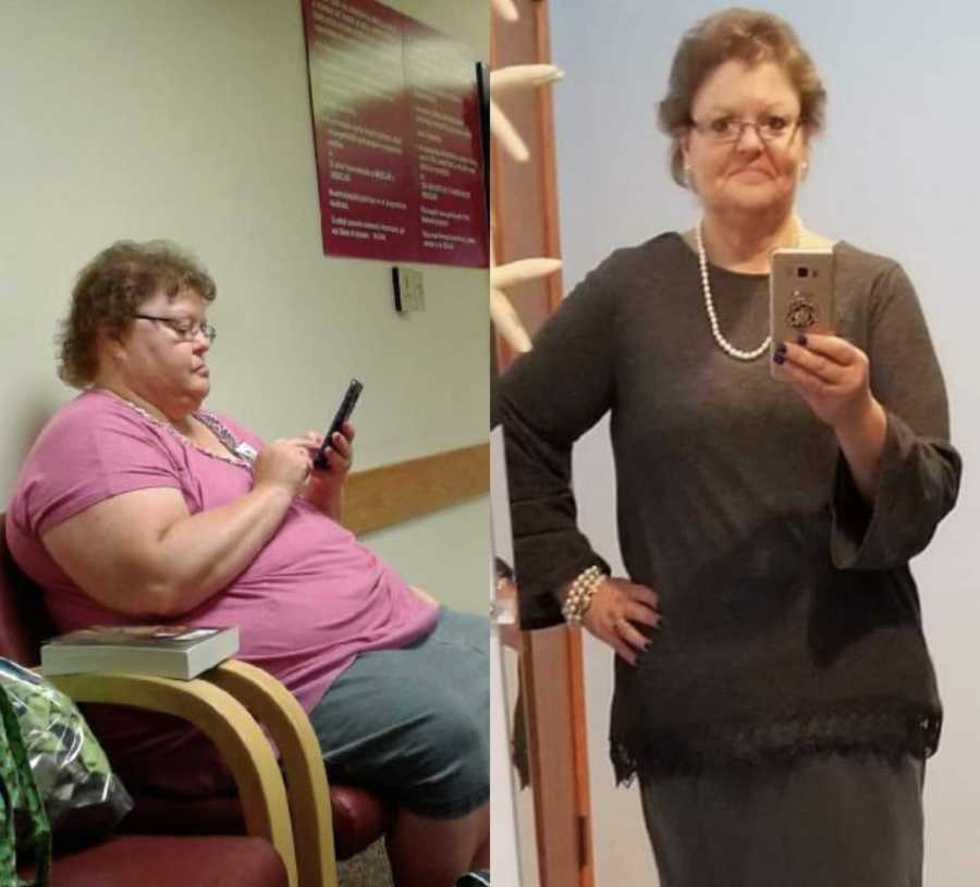 Side by side of woman with fibromyalgia sitting in chair and her in mirror selfie after losing weight