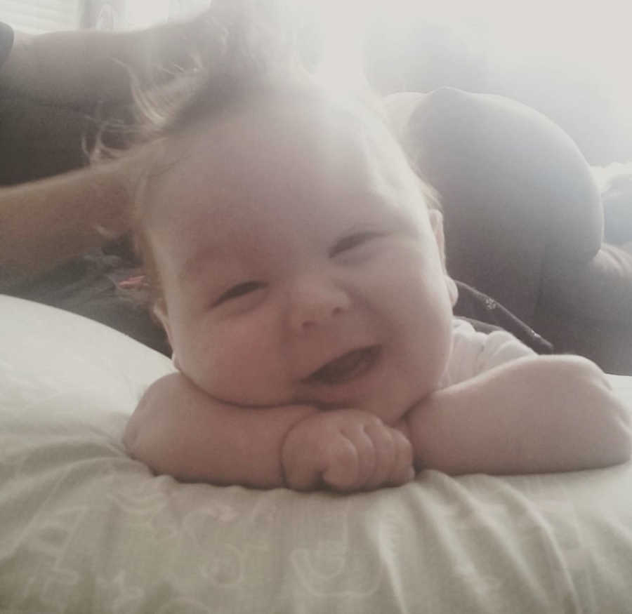 Baby with Hypotiona lays on stomach smiling with his head resting on his arms